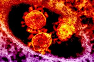 Image of coronavirus particles